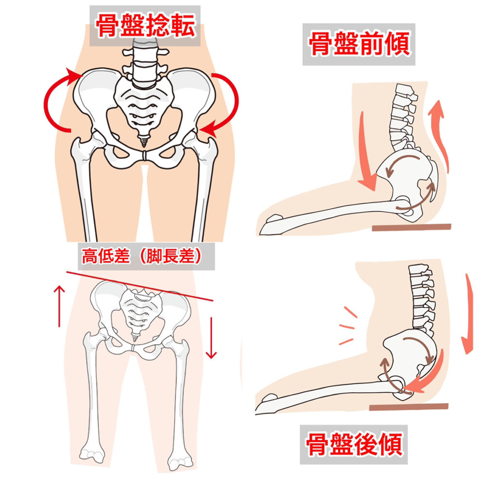 産後の整体、私に合う骨盤矯正はどれ？施術方法一覧