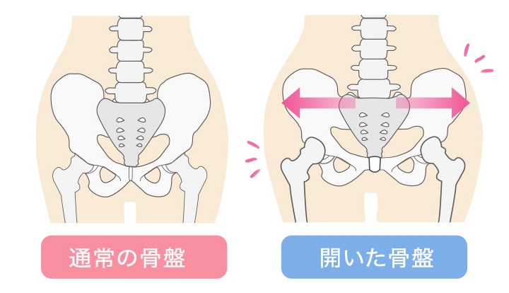 【ママ専用骨盤ショーツ】マジカルシェリー【素敵ママおすすめ商品】